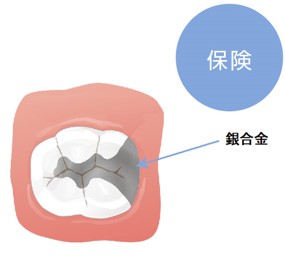 補綴治療