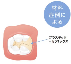 補綴治療