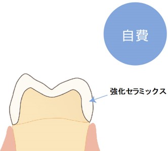 補綴治療