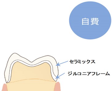 補綴治療