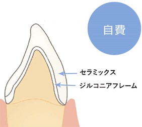 補綴治療