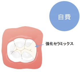 補綴治療